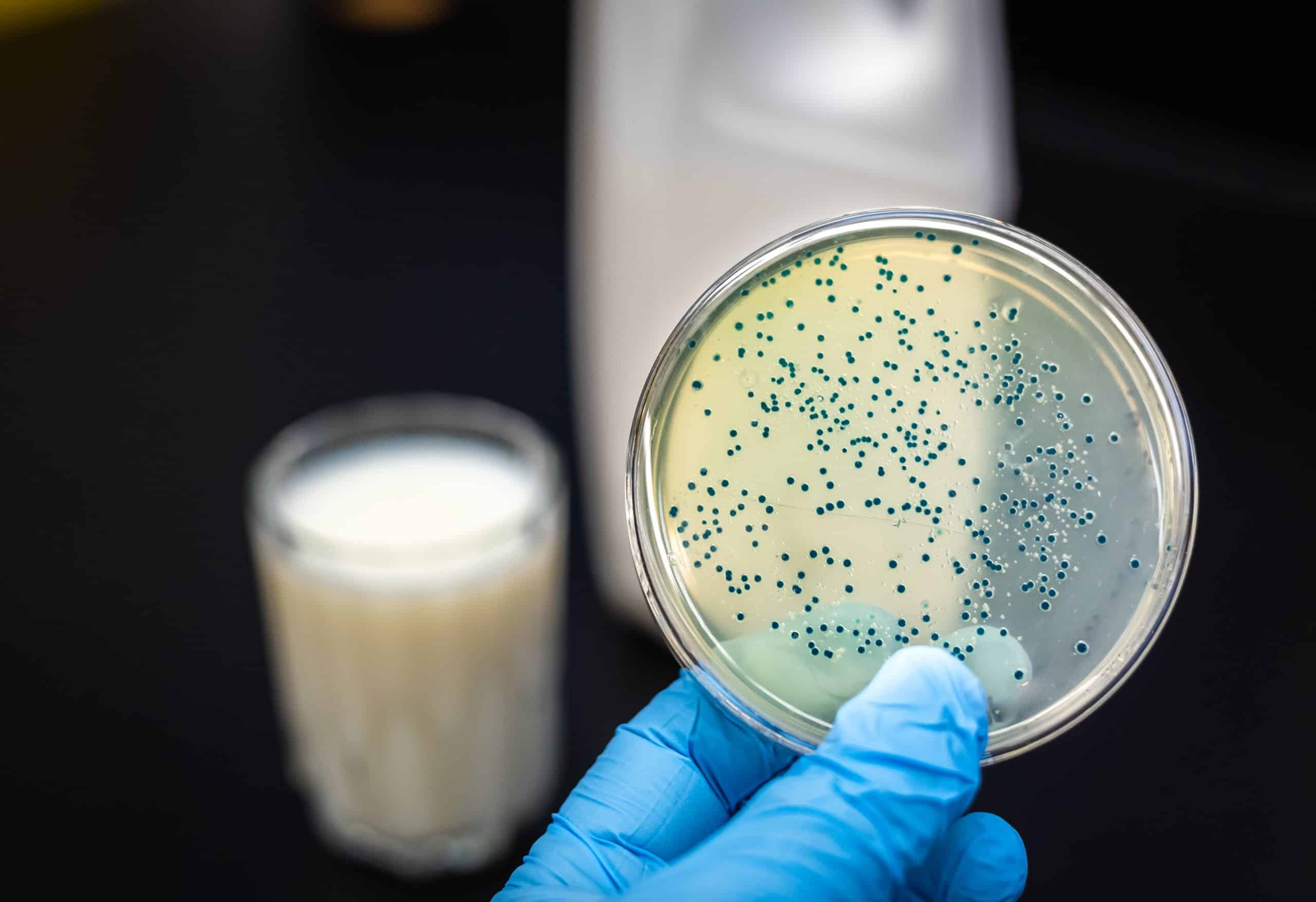 Производство кисломолочных бактерий. Бруцелла бактерия. Молоко и бактерии. Микроорганизмы молока. Молочнокислые бактерии в молоке.